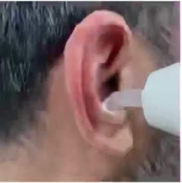 耳鼻ハンドル