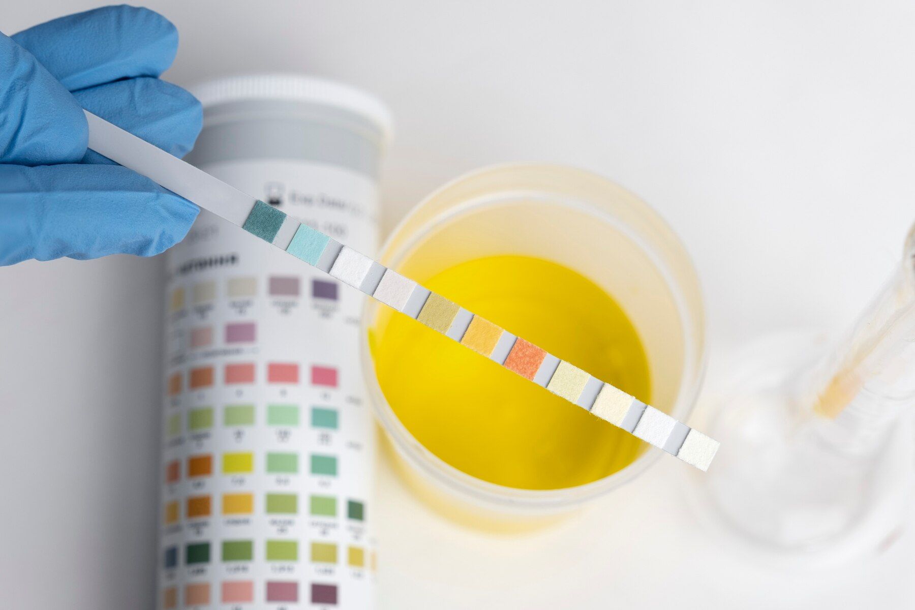 What Does hCG in Urine Look Like