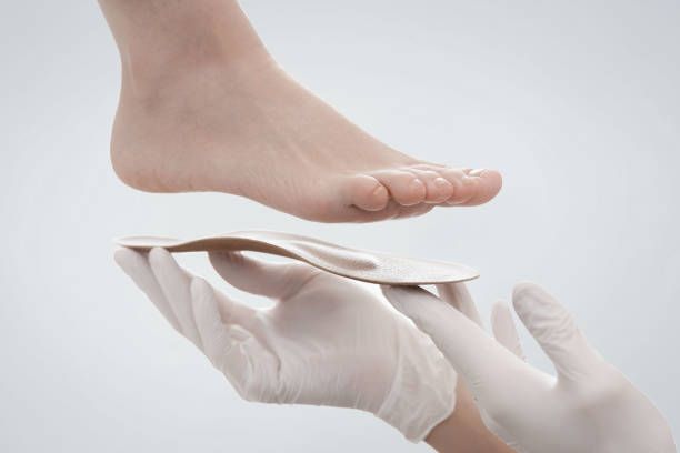 The Lifespan of Orthopedic Insoles