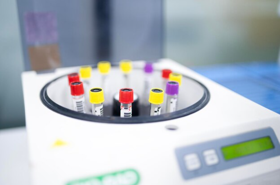 What is Elution in Chromatography?
